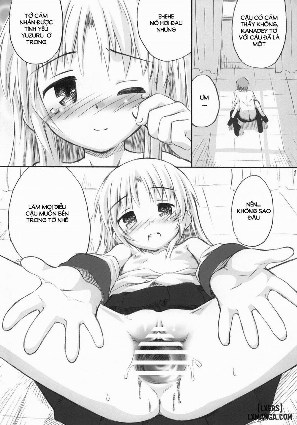 Kimi no Hitomi wa 100 Man Volt Oneshot trang 15